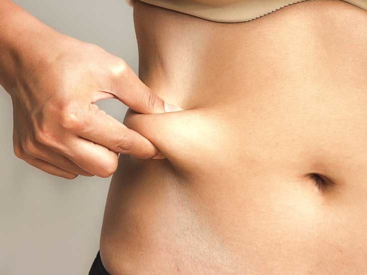 CoolSculpting to Get Rid of Stubborn Belly Fat